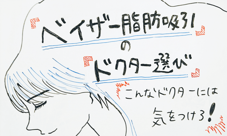 【ベイザー脂肪吸引のドクター選び】こんなドクターは気をつけろ！