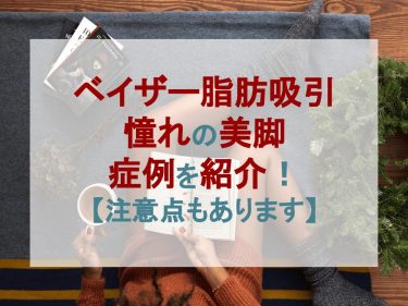 ベイザー脂肪吸引憧れの美脚になった症例を紹介！【注意点もあります】