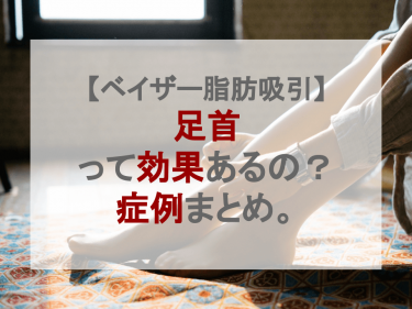 【ベイザー脂肪吸引】足首って効果あるの？症例まとめ