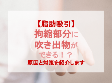 【脂肪吸引】拘縮部分に吹き出物ができる！？原因と対策を紹介します